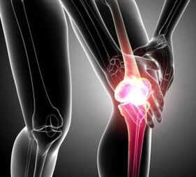 Knee pain in arthritis and arthrosis