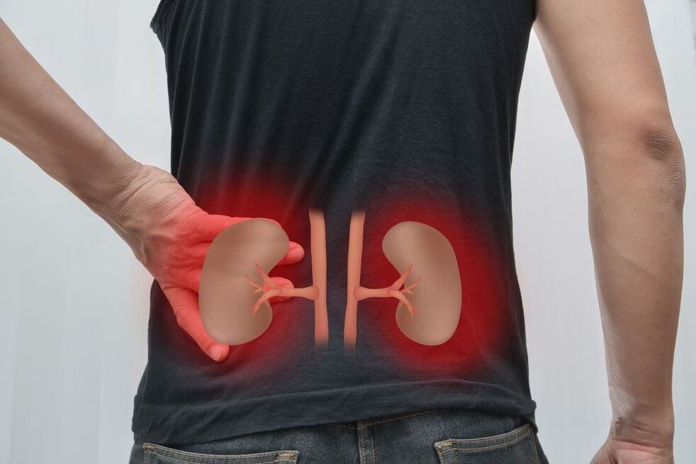 kidney inflammation due to back pain