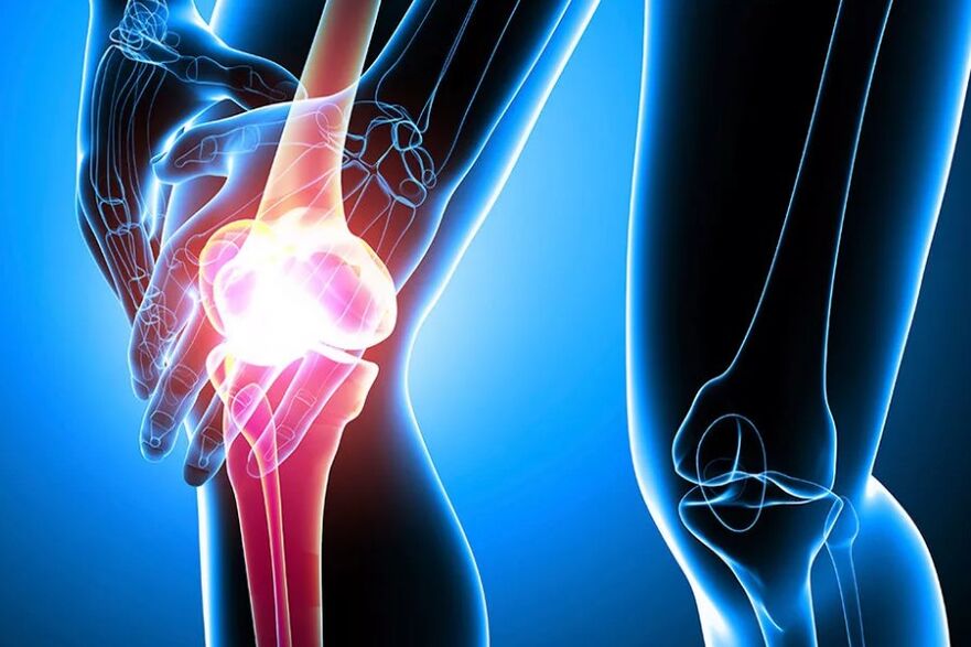 Knee pact