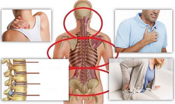 Disease location for osteochondrosis