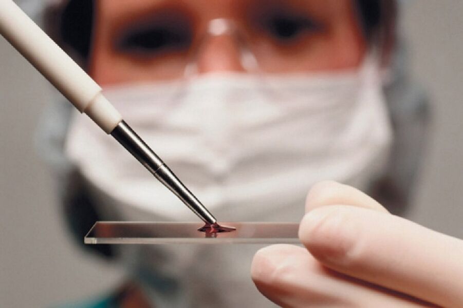 Arthritis is an inflammatory disease and its presence is detected by a blood test.